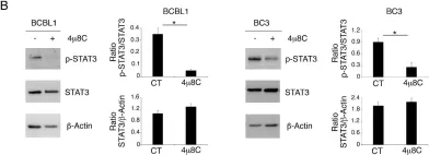 Fig.2.B showing Western Blotting from the publication: IRE1 Alpha/XBP1 Axis Sustains Primary Effusion Lymphoma Cell Survival by Promoting Cytokine Release and STAT3 Activation.