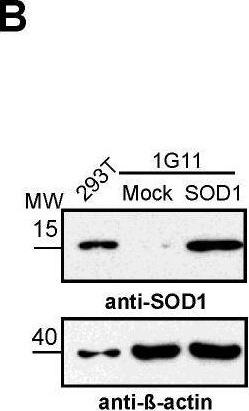 Fig.3.B showing Western Blotting from the publication: Superoxide Dismutase-3 Downregulates Laminin α5 Expression in Tumor Endothelial Cells via the Inhibition of Nuclear Factor Kappa B Signaling.