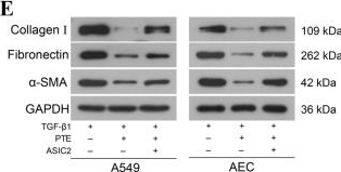 Fig.4.E showing Western Blotting from the publication: Pterostilbene alleviates pulmonary fibrosis by regulating ASIC2.