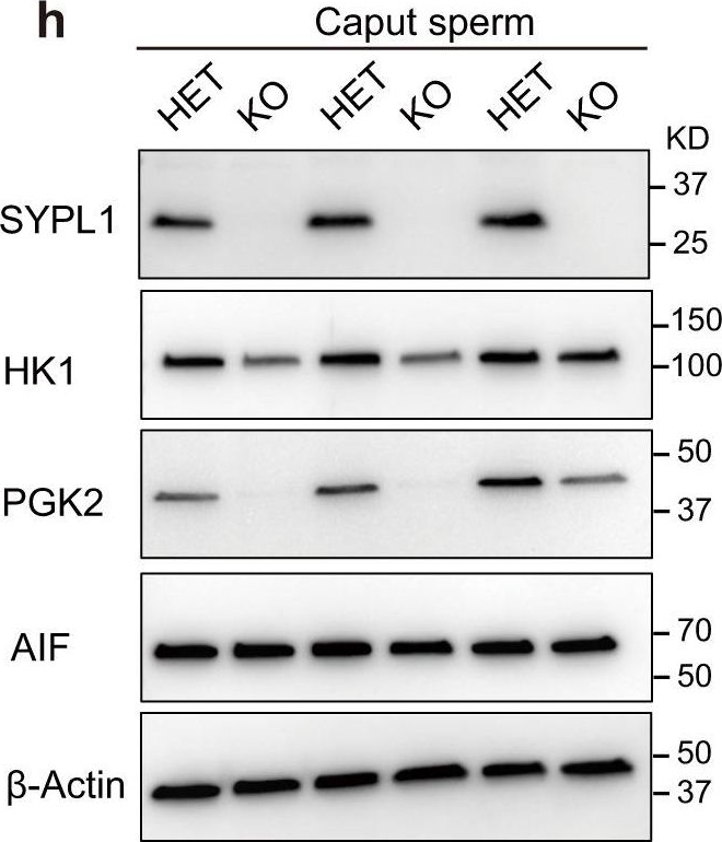 Fig.3.H showing Western Blotting in a Mus musculus (House mouse) sample from the publication: SYPL1 defines a vesicular pathway essential for sperm cytoplasmic droplet formation and male fertility.