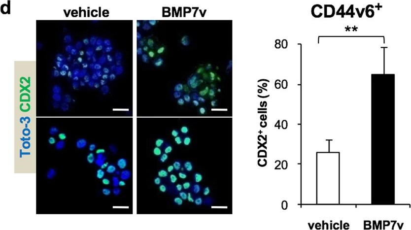 Fig.2.D showing Immunohistochemistry-paraffin-immunofluorescence in a Homo sapiens (Human) sample from the publication: Targeting chemoresistant colorectal cancer via systemic administration of a BMP7 variant.
