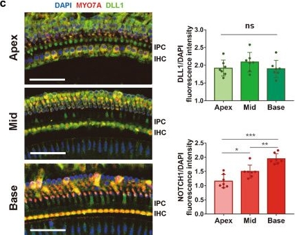 Fig.4.C showing Immunohistochemistry-immunofluorescence in a Mus musculus (House mouse) sample from the publication: Differential genetic diagnoses of adult post-lingual hearing loss according to the audiogram pattern and novel candidate gene evaluation.