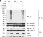 Fig.4.B showing Western Blotting in a Homo sapiens (Human) sample from the publication: IL-6 receptor blockade corrects defects of XIAP-deficient regulatory T cells.