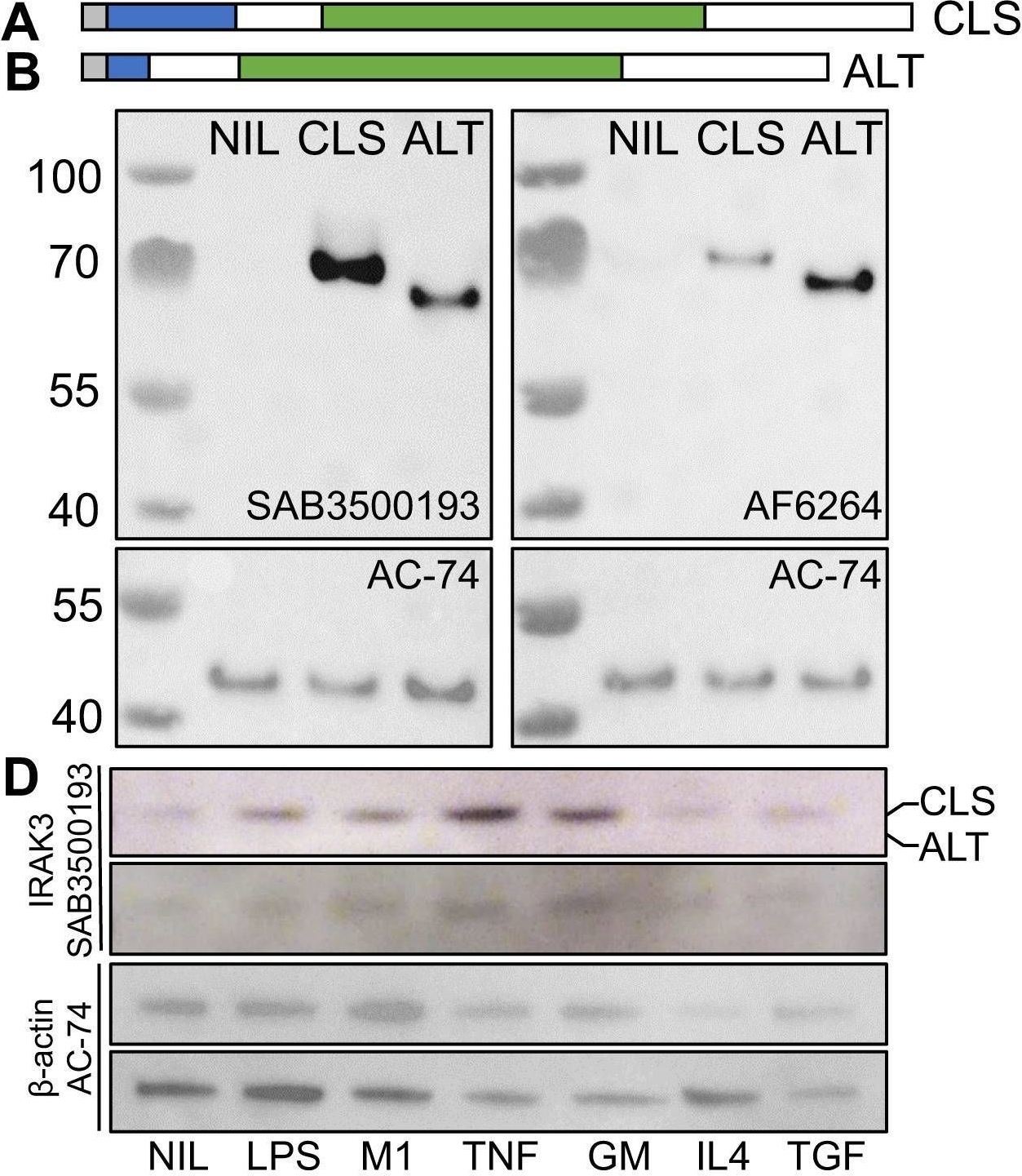 Fig.1.A showing Western Blotting in a Homo sapiens (Human) sample from the publication: IRAK3 is upregulated in rheumatoid arthritis synovium and delays the onset of experimental arthritis.