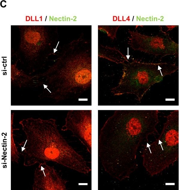 Fig.4.C showing Immunofluorescence in a Mus musculus (House mouse) sample from the publication: MPDZ promotes DLL4-induced Notch signaling during angiogenesis.