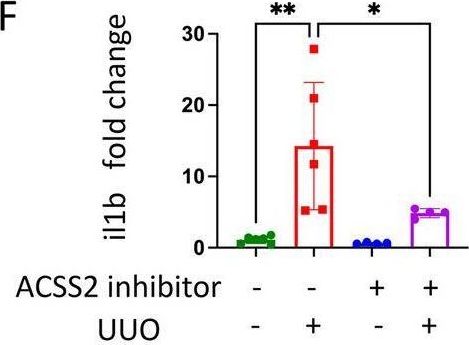Fig.8.F from the publication: Inhibition of ACSS2-mediated histone crotonylation alleviates kidney fibrosis via IL-1β-dependent macrophage activation and tubular cell senescence.