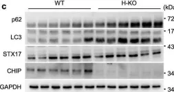 Fig.5.C showing Western Blotting from the publication: CHIP ameliorates nonalcoholic fatty liver disease via promoting K63- and K27-linked STX17 ubiquitination to facilitate autophagosome-lysosome fusion.