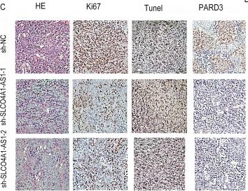 Fig.6.C showing Immunohistochemistry in a Mus musculus (House mouse) sample from the publication: LncRNA SLCO4A1-AS1 promotes colorectal cancer cell proliferation by enhancing autophagy via miR-508-3p/PARD3 axis.