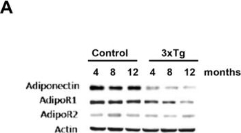 Fig.1.A showing Western Blotting in a Mus musculus (House mouse) sample from the publication: Adiponectin Receptor Agonist Ameliorates Synaptic Dysfunction in 3xTg Alzheimer's Disease Mouse Model by Activation of AMPK.