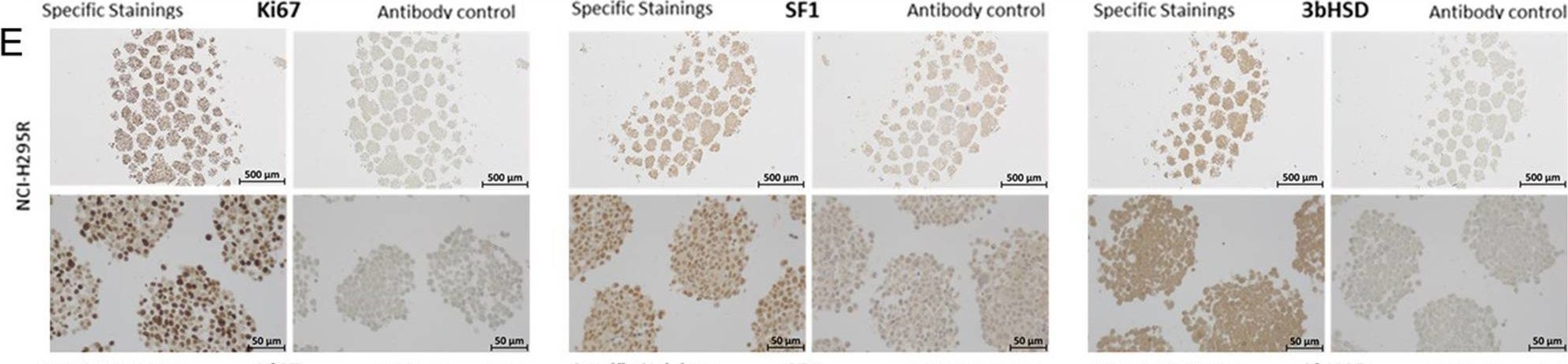 Fig.3.E showing Immunohistochemistry in a Homo sapiens (Human) sample from the publication: Innovative multidimensional models in a high-throughput-format for different cell types of endocrine origin.