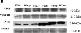 Fig.5.E showing Western Blotting from the publication: Exercise-induced angiogenesis is attenuated by captopril but maintained under perindopril treatment in hypertensive rats.
