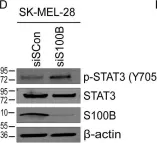 Fig.2.D showing Western Blotting from the publication: The calcium-binding protein S100B reduces IL6 production in malignant melanoma via inhibition of RSK cellular signaling.