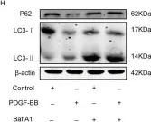 Fig.5.H showing Western Blotting in a Homo sapiens (Human) sample from the publication: Myocardin/microRNA-30a/Beclin1 signaling controls the phenotypic modulation of vascular smooth muscle cells by regulating autophagy.