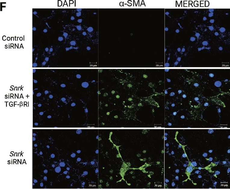 Fig.4.F showing Immunocytochemistry-immunofluorescence from the publication: SNRK facilitates cardiac repair associated with nonischemic fibrosis: regulating transforming growth factor-beta1 levels in atrial cardiomyocytes.