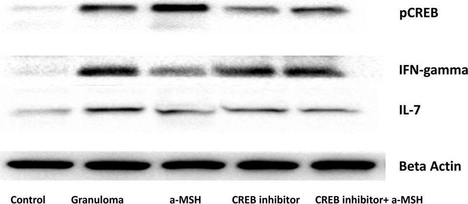 Fig.4.A showing Western Blotting in a Homo sapiens (Human) sample from the publication: Anti-inflammatory effects of α-MSH through p-CREB expression in sarcoidosis like granuloma model.