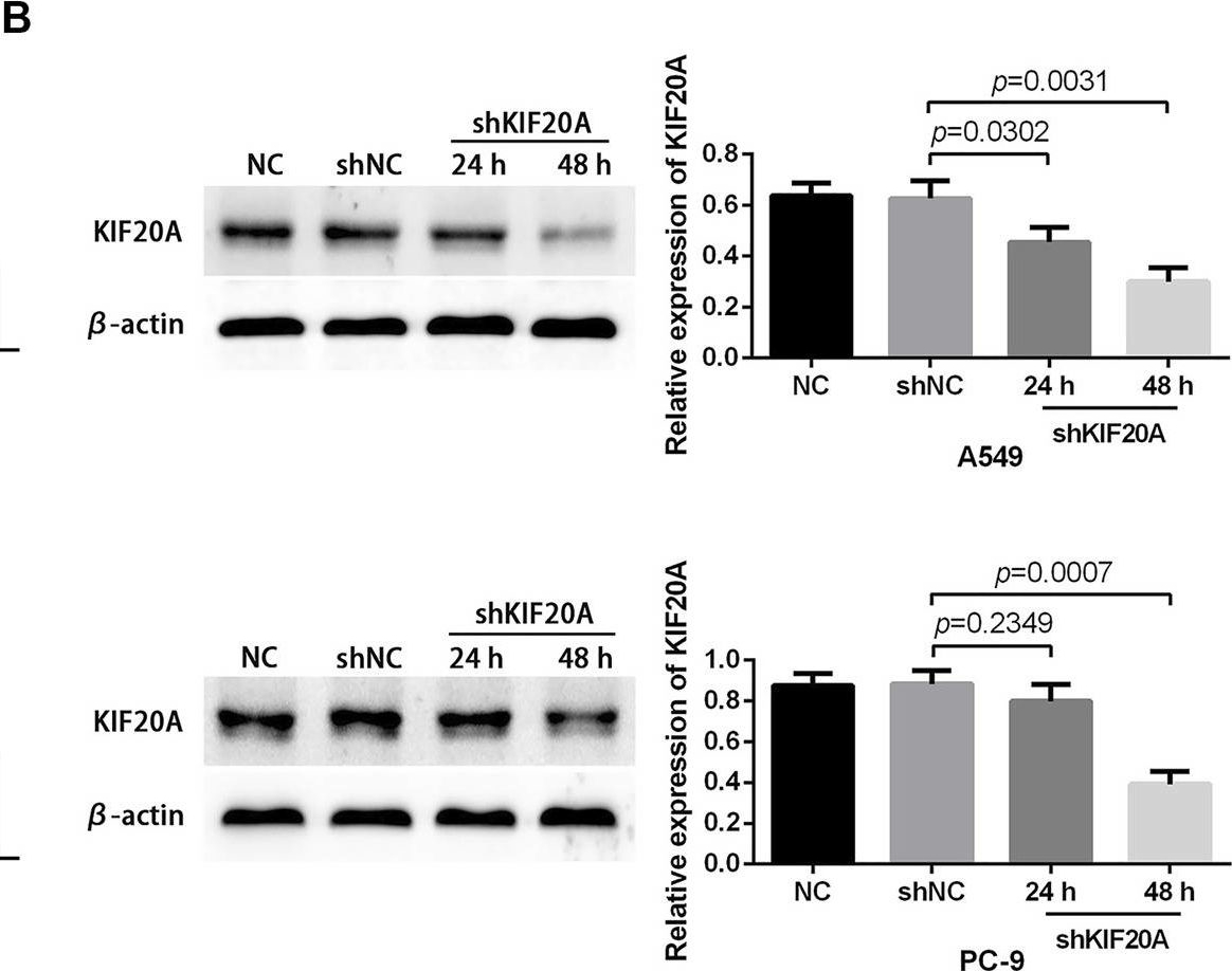 Fig.10.B showing Western Blotting in a Homo sapiens (Human) sample from the publication: An evaluation of KIF20A as a prognostic factor and therapeutic target for lung adenocarcinoma using integrated bioinformatics analysis.