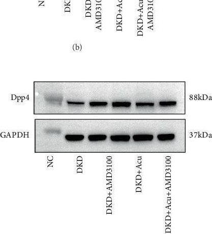 Fig.8.Z showing Western Blotting from the publication: Transcriptomics and Proteomics Reveal That TLPW Acupuncture Ameliorates Proteinuria in Diabetic Kidney Disease Model Rats by Suppressing Epithelial-to-Mesenchymal Transition via the DPP4/SDF-1α/TGF-β/Smad Signalling Axis.