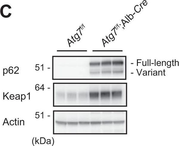 Negative Regulation of the Keap1-Nrf2 Pathway by a p62/Sqstm1 Splicing Variant.
