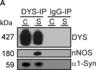 Fig.2.A showing Western Blotting from the publication: Proteomic analysis reveals new cardiac-specific dystrophin-associated proteins.