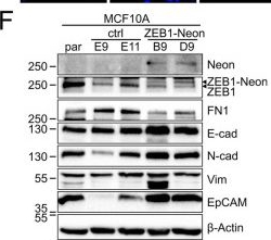 Fig.1.F showing Western Blotting from the publication: A ZEB1-Neon knock-in uncovers traceable dynamics of epithelial-mesenchymal transition in tumors in vivo.