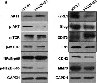 Fig.8.B showing Western Blotting from the publication: COPB2 drives gastric cancer progression via PI3K/AKT/NF-κB signaling: a multi-omics and functional study.
