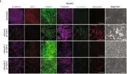 Fig.1.F showing Immunofluorescence in a Homo sapiens (Human) sample from the publication: FBXO32 promotes microenvironment underlying epithelial-mesenchymal transition via CtBP1 during tumour metastasis and brain development.