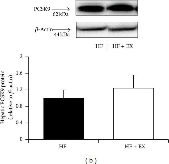 Fig.3.B showing Enzyme-linked immunosorbent assay in a Mus musculus (House mouse) sample from the publication: Treadmill Exercise Training Modulates Hepatic Cholesterol Metabolism and Circulating PCSK9 Concentration in High-Fat-Fed Mice.