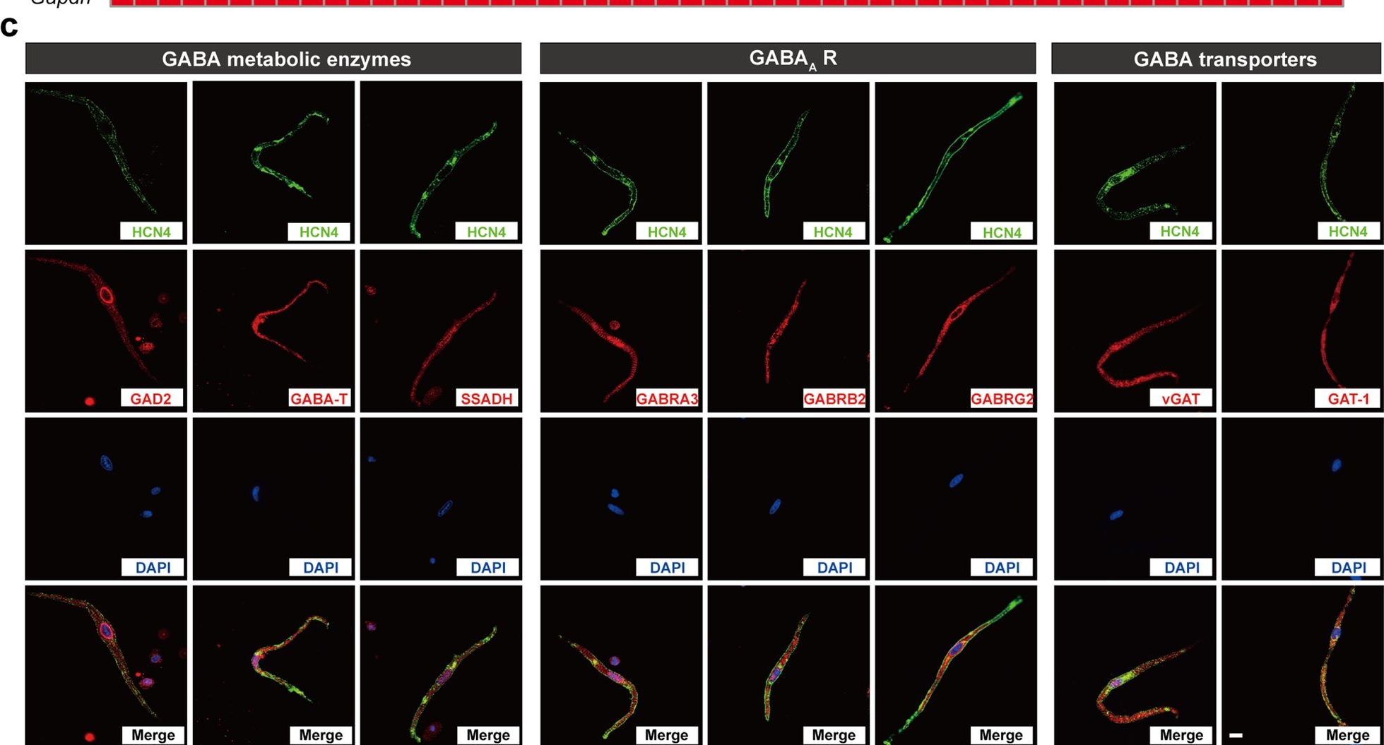 Fig.2.C showing Immunocytochemistry-immunofluorescence in a Mus musculus (House mouse) sample from the publication: A GABAergic system in atrioventricular node pacemaker cells controls electrical conduction between the atria and ventricles.