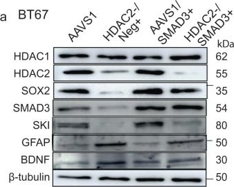 Fig.6.A showing Western Blotting in a Homo sapiens (Human) sample from the publication: Epigenetic and molecular coordination between HDAC2 and SMAD3-SKI regulates essential brain tumour stem cell characteristics.