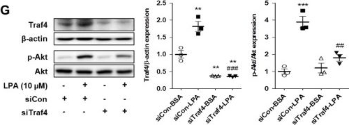 Fig.8.G showing Western Blotting from the publication: Inhibition of ChREBP ubiquitination via the ROS/Akt-dependent downregulation of Smurf2 contributes to lysophosphatidic acid-induced fibrosis in renal mesangial cells.