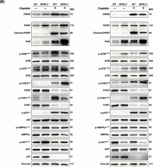 Fig.5.B showing Western Blotting in a Homo sapiens (Human) sample from the publication: GATOR1 complex controls cisplatin sensitivity.