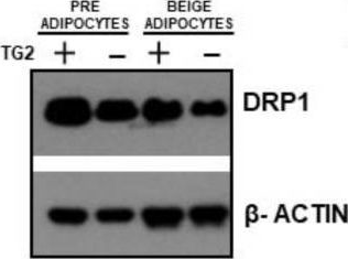 Fig.5.I showing Western Blotting in a Mus musculus (House mouse) sample from the publication: Tissue Transglutaminase Knock-Out Preadipocytes and Beige Cells of Epididymal Fat Origin Possess Decreased Mitochondrial Functions Required for Thermogenesis.