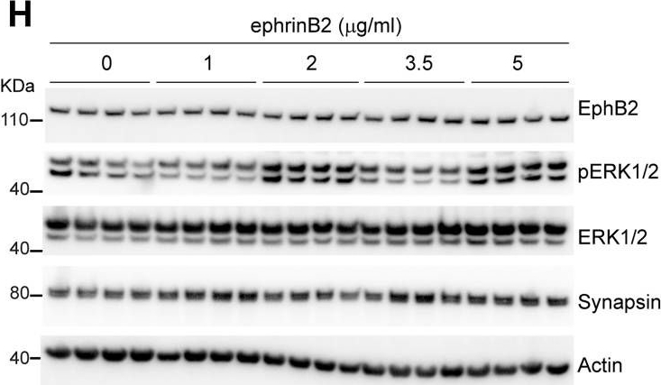 Fig.3.H showing Western Blotting in a Rattus norvegicus (Rat) sample from the publication: The ephrin receptor EphB2 regulates the connectivity and activity of enteric neurons.