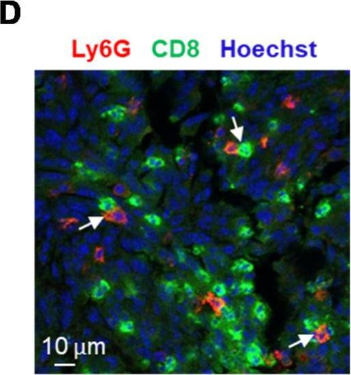 Fig.4.D showing Immunohistochemistry-immunofluorescence from the publication: Tumor-Associated Neutrophils Dampen Adaptive Immunity and Promote Cutaneous Squamous Cell Carcinoma Development.