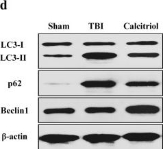 Fig.3.D showing Western Blotting from the publication: Calcitriol confers neuroprotective effects in traumatic brain injury by activating Nrf2 signaling through an autophagy-mediated mechanism.