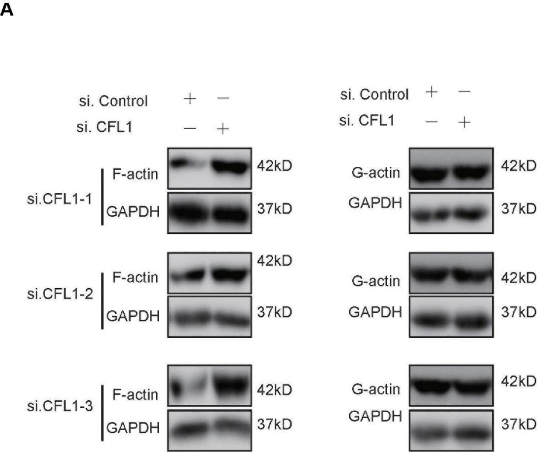 Fig.5.A showing Western Blotting in a Homo sapiens (Human) sample from the publication: Nujiangexanthone A Inhibits Hepatocellular Carcinoma Metastasis via Down Regulation of Cofilin 1.