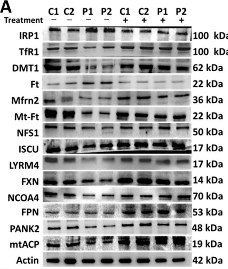 Fig.5.A showing Western Blotting in a Homo sapiens (Human) sample from the publication: Polydatin and Nicotinamide Prevent Iron Accumulation and Lipid Peroxidation in Cellular Models of Mitochondrial Diseases.