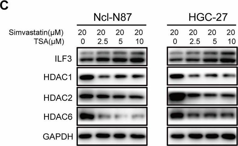 Fig.5.C showing Western Blotting in a Homo sapiens (Human) sample from the publication: Simvastatin inhibits PD-L1 via ILF3 to induce ferroptosis in gastric cancer cells.