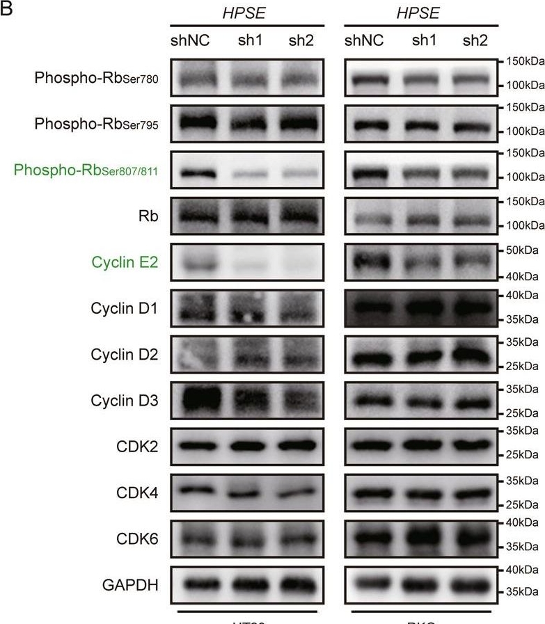 Fig.4.B showing Western Blotting from the publication: Heparanase modulates the prognosis and development of BRAF V600E-mutant colorectal cancer by regulating AKT/p27Kip1/Cyclin E2 pathway.