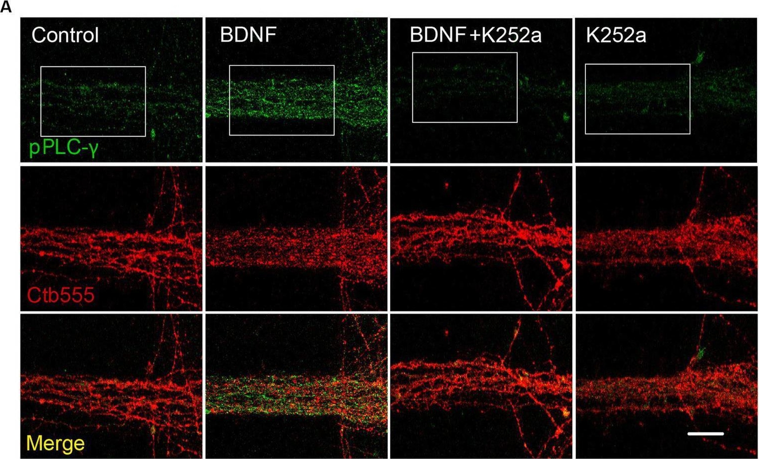 Fig.3.A from the publication: PLC-γ-Ca2+ pathway regulates axonal TrkB endocytosis and is required for long-distance propagation of BDNF signaling.