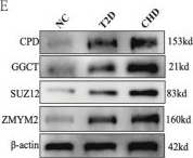 Fig.7.E showing Western Blotting from the publication: Computational-experimental strategy identifies Co-upregulated biomarkers linking coronary heart disease and type 2 diabetes pathogenesis.