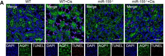 Fig.2.A showing Immunohistochemistry-immunofluorescence in a Mus musculus (House mouse) sample from the publication: MiR-155 deficiency protects renal tubular epithelial cells from telomeric and genomic DNA damage in cisplatin-induced acute kidney injury.