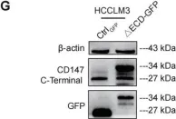 Fig.5.G showing Western Blotting from the publication: Targeting autophagy in HCC treatment: exploiting the CD147 internalization pathway.