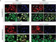 Fig.5.C showing Immunocytochemistry-immunofluorescence from the publication: BART inhibits pancreatic cancer cell invasion by PKCα inactivation through binding to ANX7.