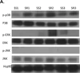Fig.1.A showing Western Blotting in a Homo sapiens (Human) sample from the publication: Activated p38 MAPK in Peripheral Blood Monocytes of Steroid Resistant Asthmatics.