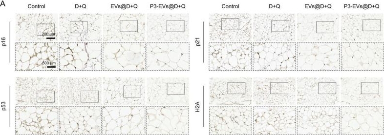 Fig.7.A showing Immunohistochemistry in a Mus musculus (House mouse) sample from the publication: Suppression of senescent metabolism of adipose tissue by rebalancing mitochondrial homeostasis via a selective drug delivery system.