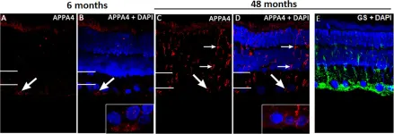 Fig.2.A showing Immunohistochemistry in a Rattus norvegicus (Rat) sample from the publication: Alzheimer's Disease-Related Protein Expression in the Retina of Octodon degus.
