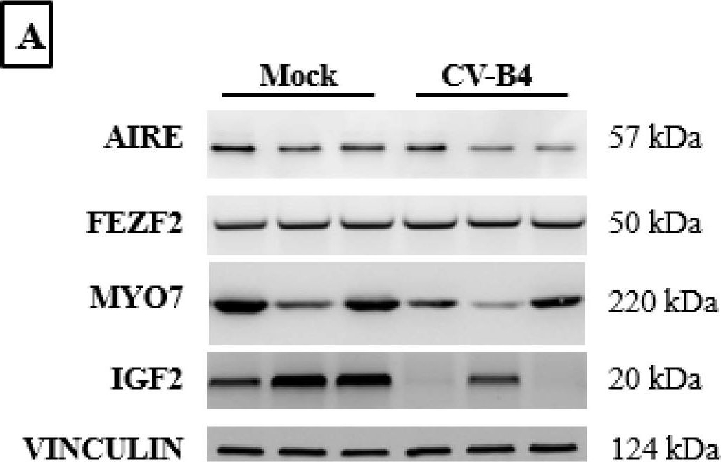 Fig.5.A showing Western Blotting in a Mus musculus (House mouse) sample from the publication: Coxsackievirus B4 Transplacental Infection Severely Disturbs Central Tolerogenic Mechanisms in the Fetal Thymus.