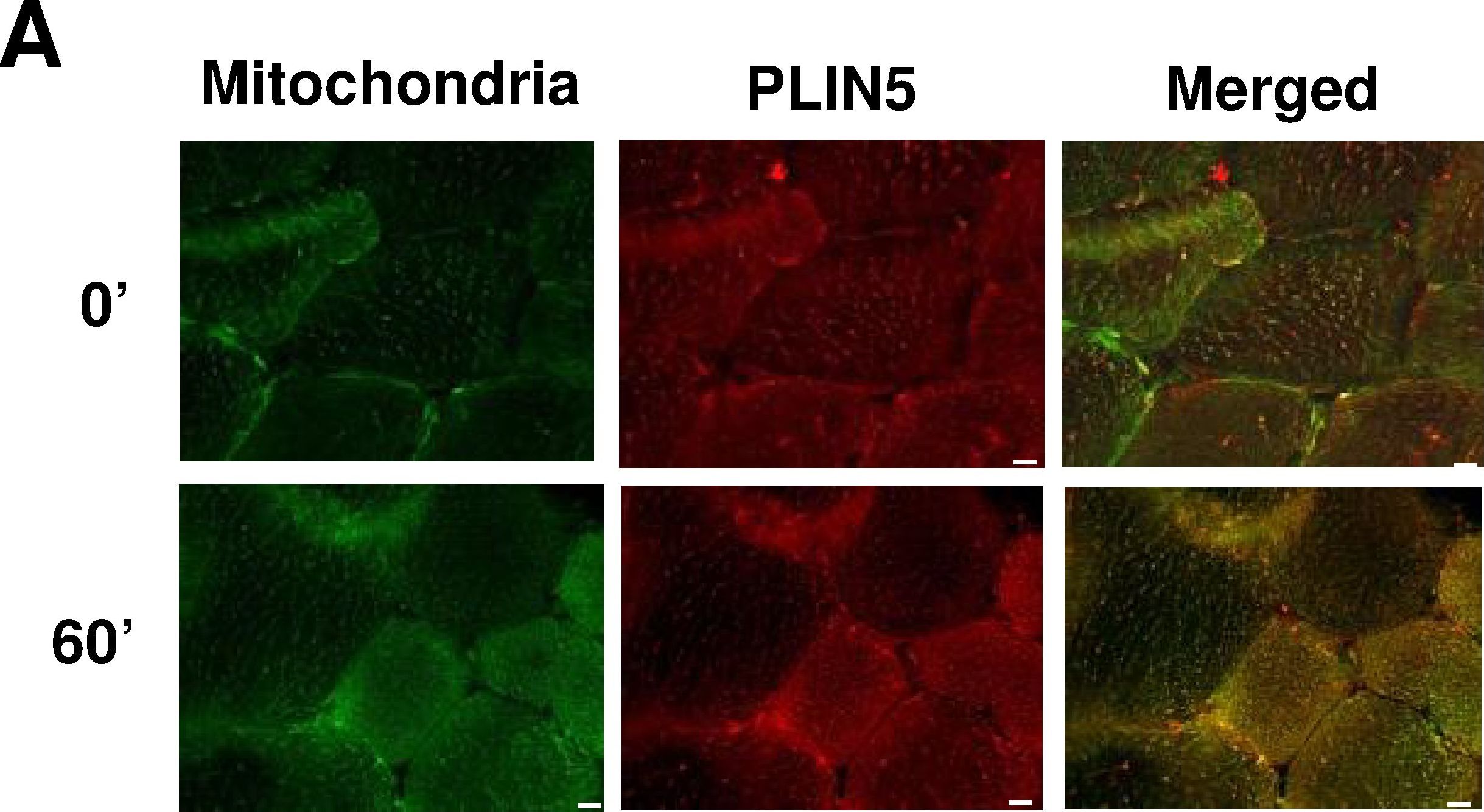 Cellular localization and associations of the major lipolytic proteins in human skeletal muscle at rest and during exercise.