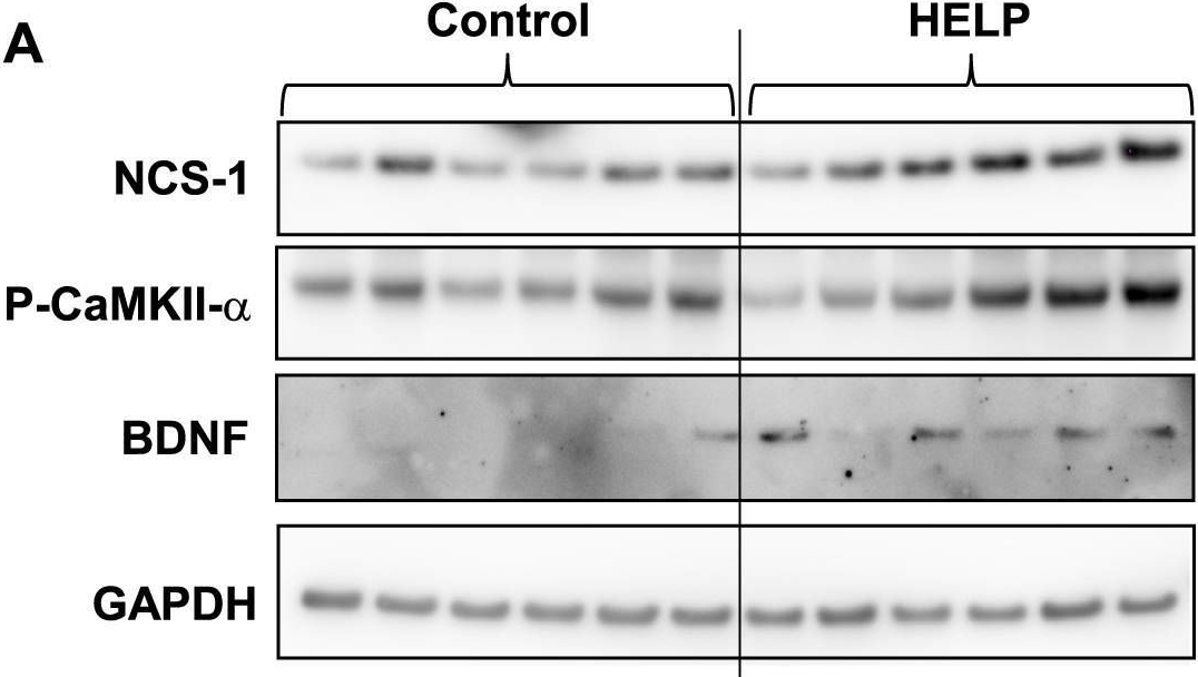 Fig.6.A showing Western Blotting from the publication: Possible Signaling Pathways Mediating Neuronal Calcium Sensor-1-Dependent Spatial Learning and Memory in Mice.